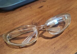 【体験談】レーシック後の後遺症について、よくある質問のまとめ